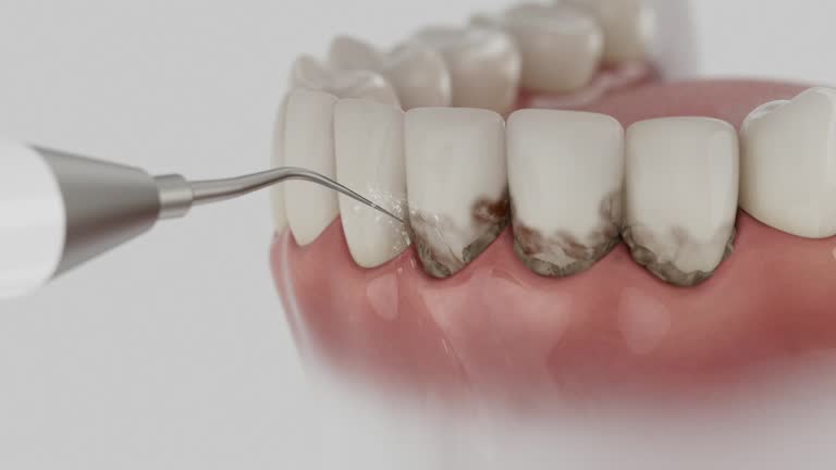 Reliable Dental contractor in Norton, VA by Smile Center Dentistry